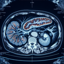 МРТ підшлункової залози