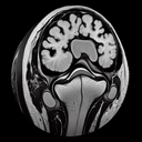 МРТ колінного суглобу